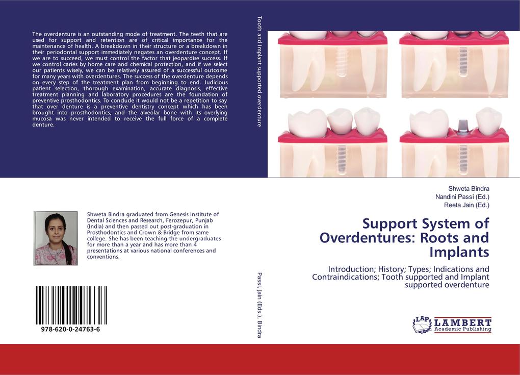 Support System of Overdentures: Roots and Implants