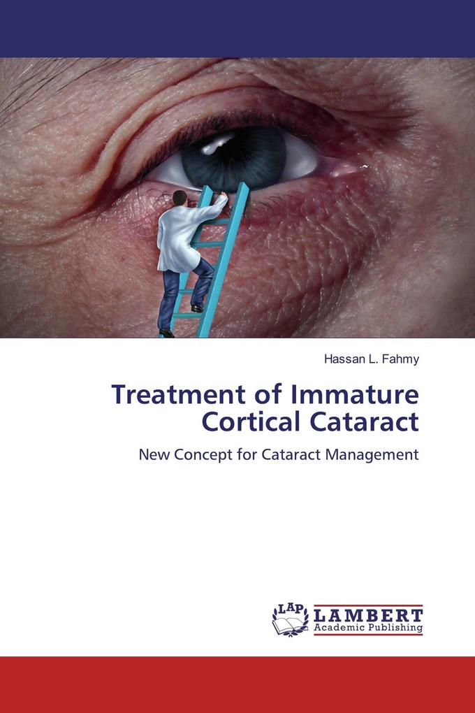 Treatment of Immature Cortical Cataract