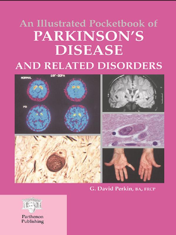 An Illustrated Pocketbook of Parkinson‘s Disease and Related Disorders