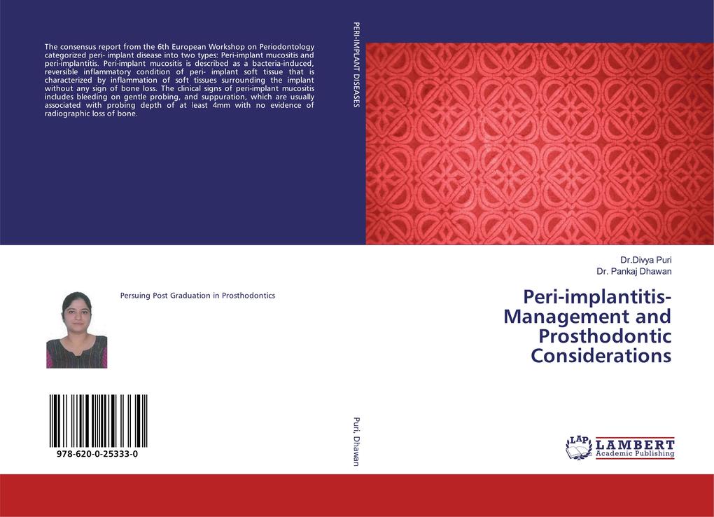 Peri-implantitis- Management and Prosthodontic Considerations
