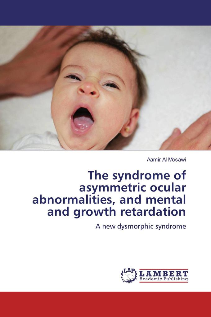 The syndrome of asymmetric ocular abnormalities and mental and growth retardation