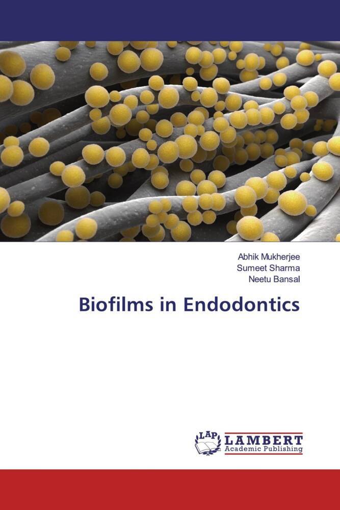 Biofilms in Endodontics