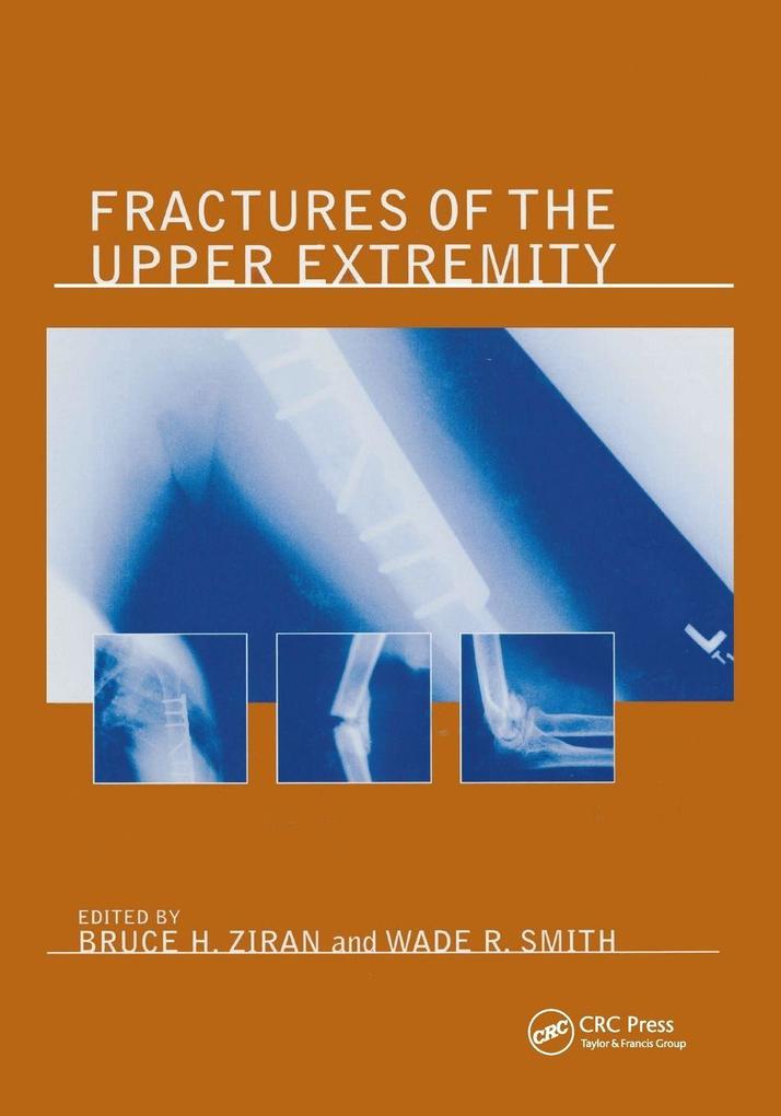 Fractures of the Upper Extremity