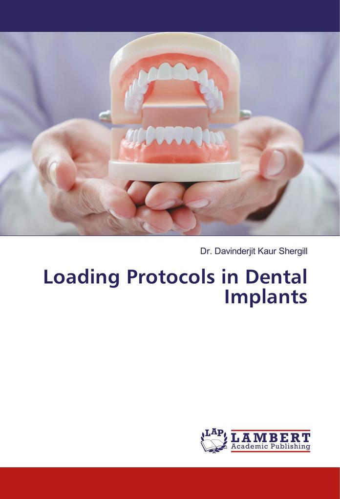 Loading Protocols in Dental Implants