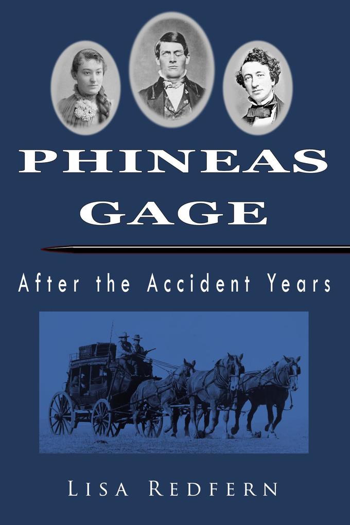 Phineas Gage After the Accident Years