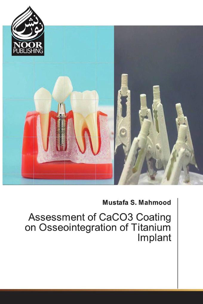 Assessment of CaCO3 Coating on Osseointegration of Titanium lmplant
