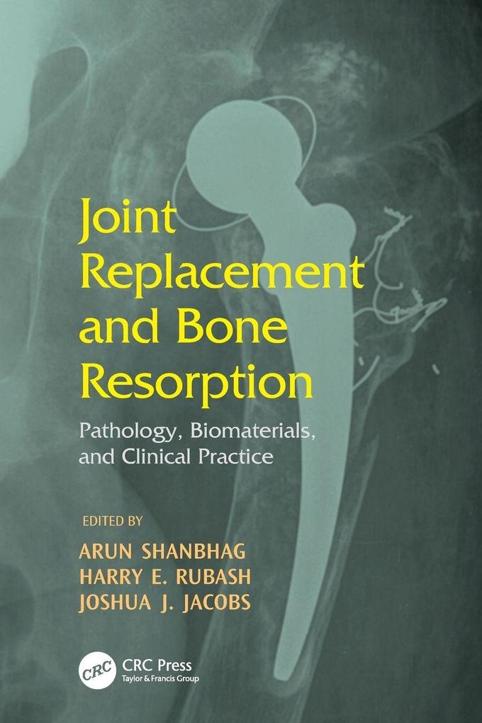 Joint Replacement and Bone Resorption