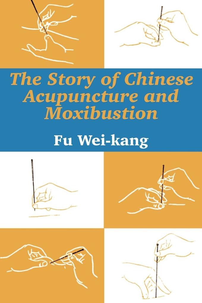 Story of Chinese Acupuncture and Moxibustion The