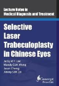 Selective Laser Trabeculoplasty in Chinese Eyes