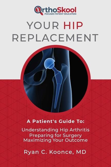Your Hip Replacement: A Patient‘s Guide To: Understanding Hip Arthritis Preparing for Surgery Maximizing Your Outcome