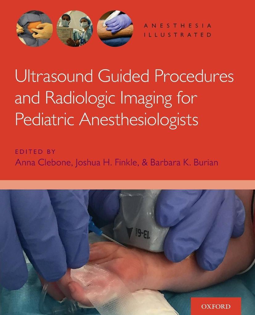 ULTRASOUND AI P