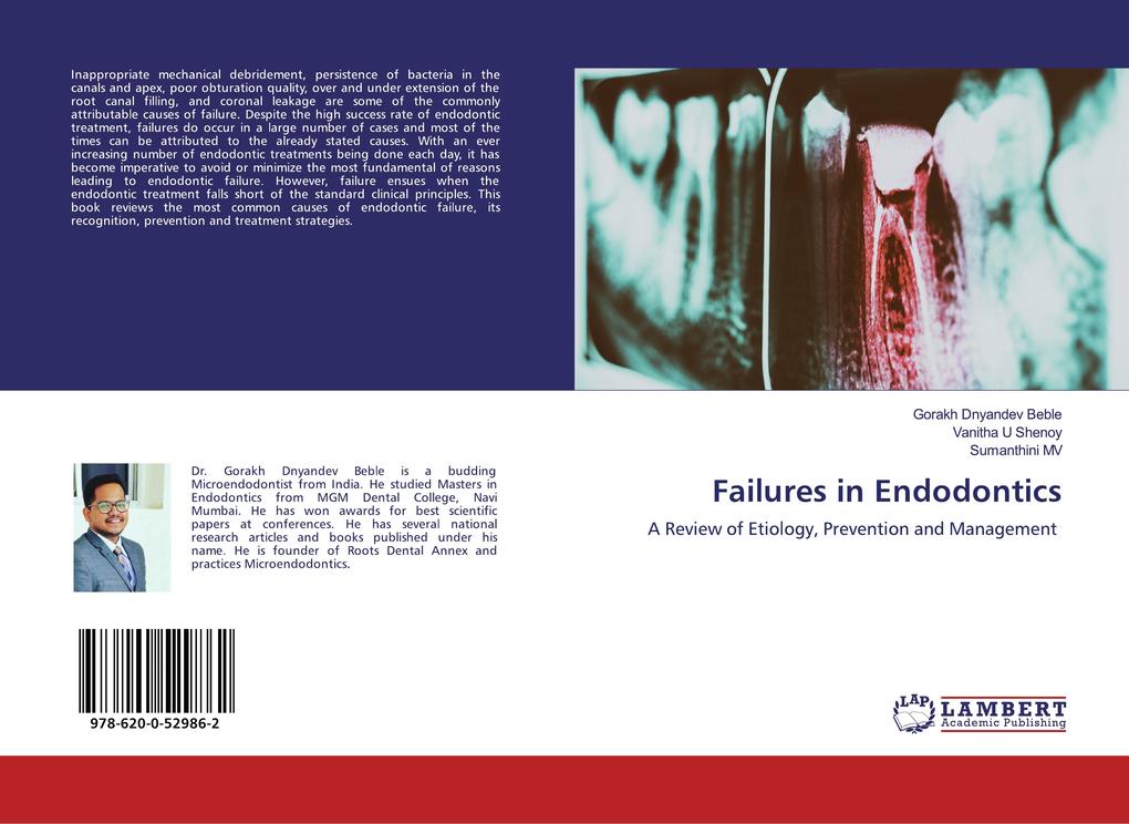 Failures in Endodontics