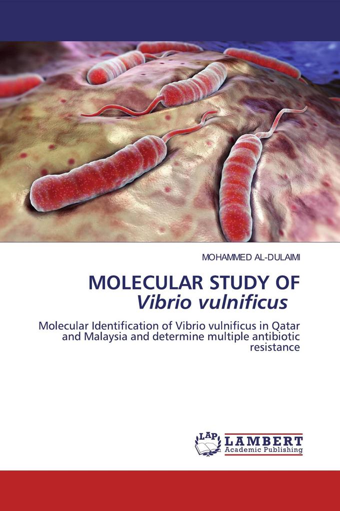 MOLECULAR STUDY OF Vibrio vulnificus