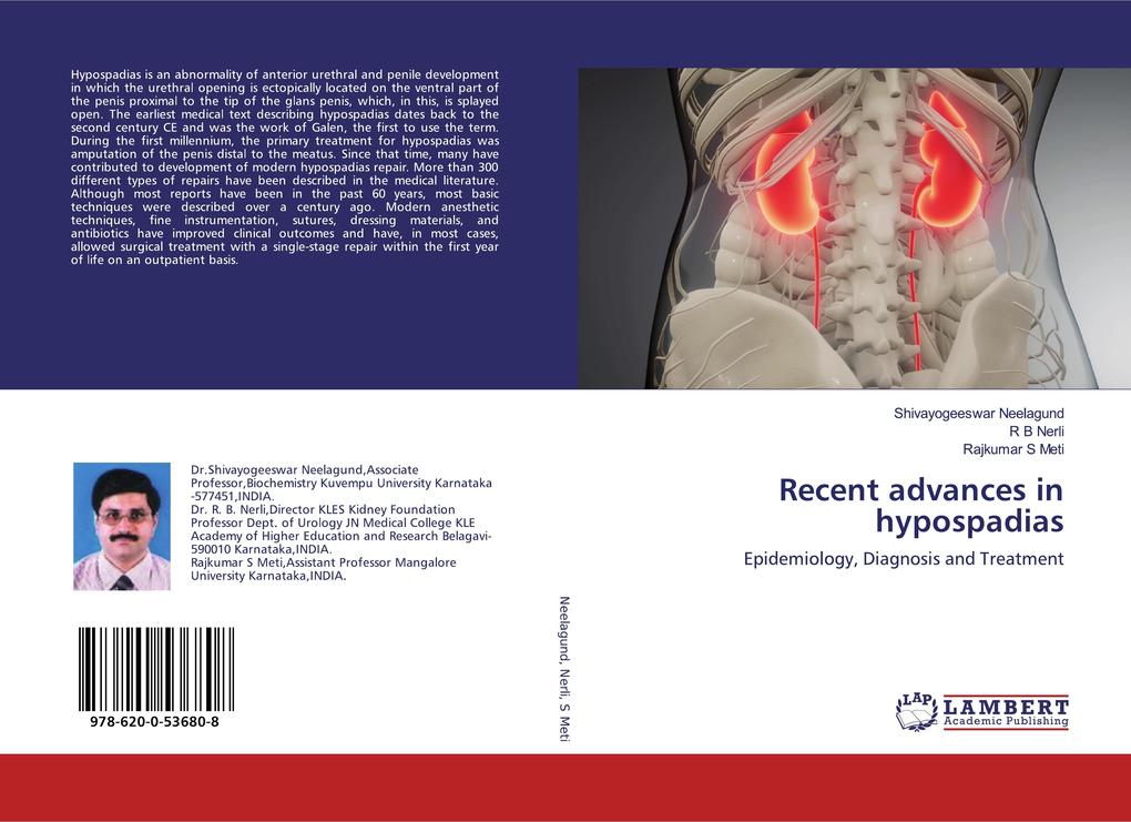 Recent advances in hypospadias