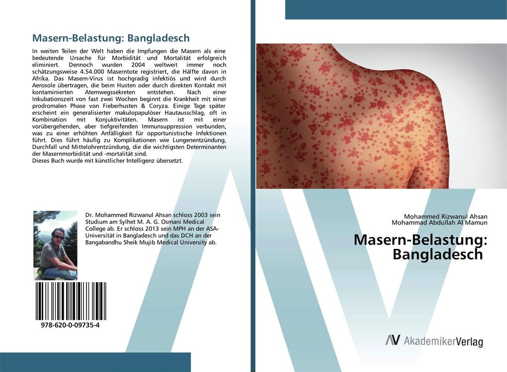 Masern-Belastung: Bangladesch