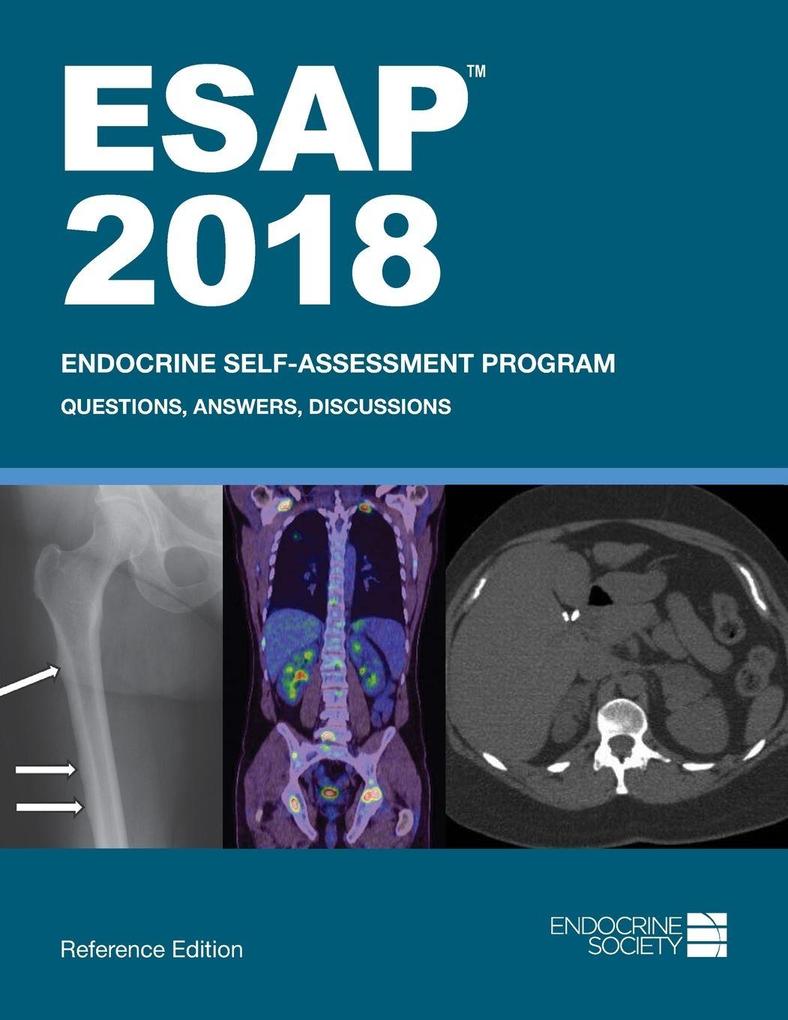 ESAP 2018 Endocrine Self-Assessment Program Questions Answers Discussions