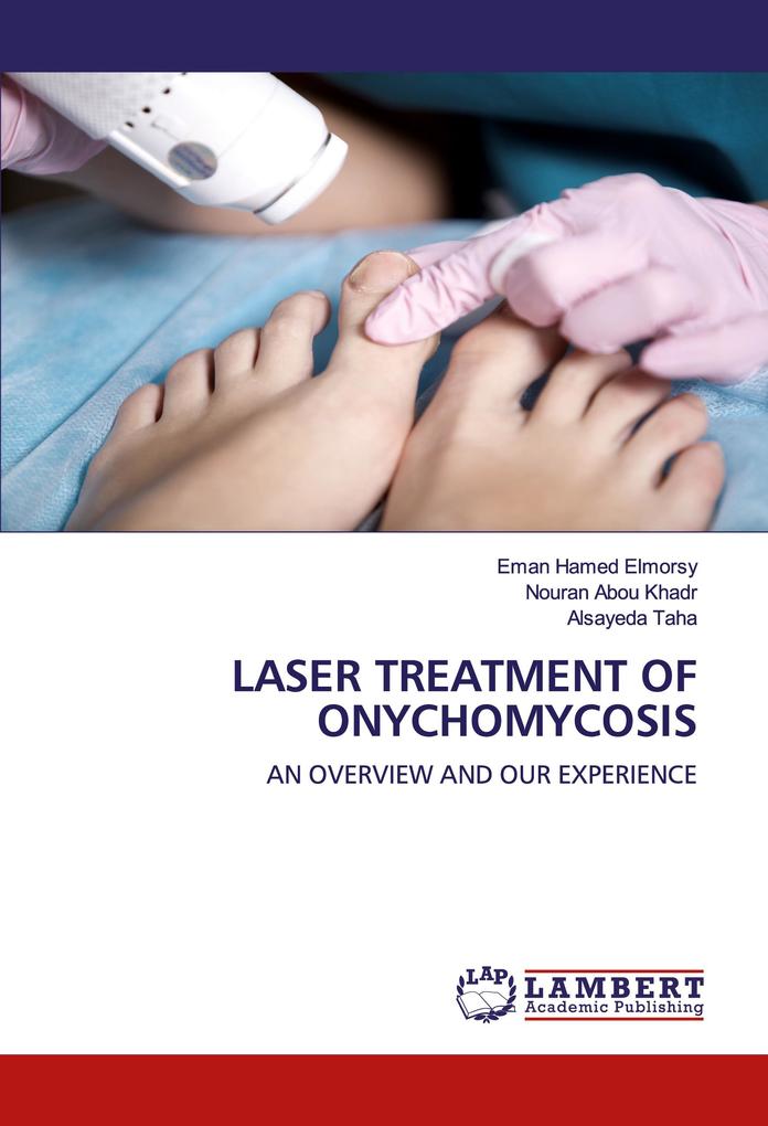 LASER TREATMENT OF ONYCHOMYCOSIS