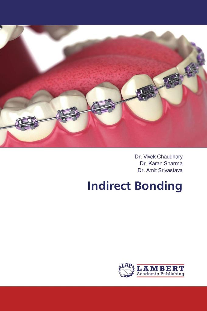 Indirect Bonding
