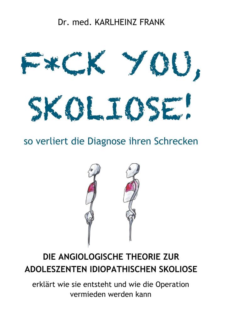 F*ck you Skoliose! So verliert die Diagnose ihren Schrecken