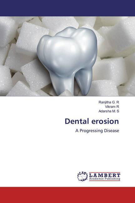 Dental erosion