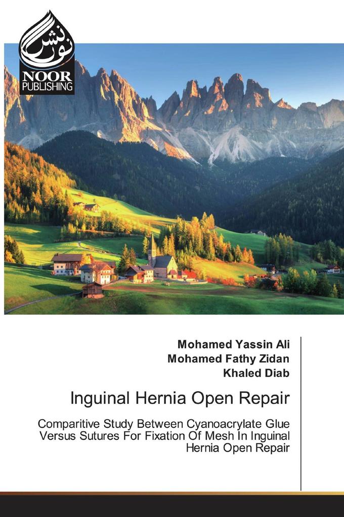 Inguinal Hernia Open Repair