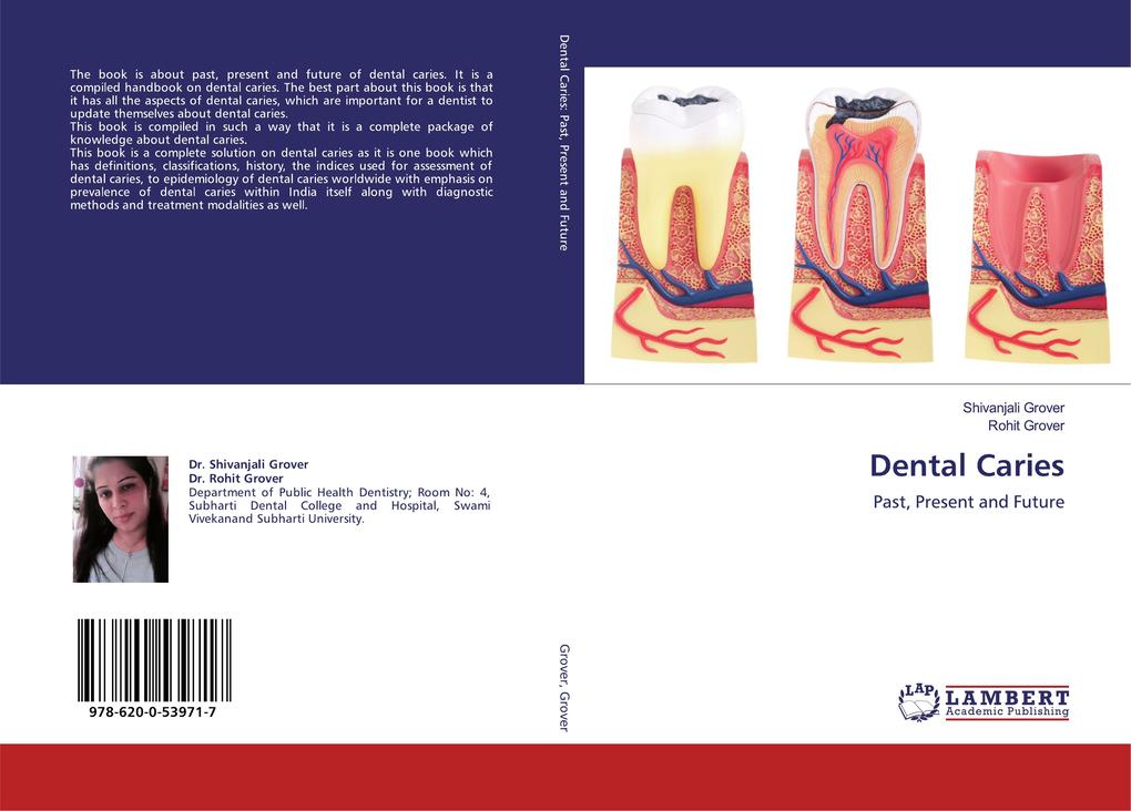 Dental Caries