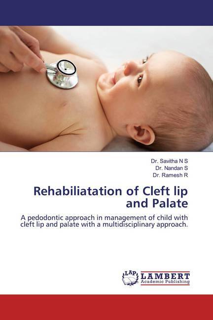 Rehabiliatation of Cleft lip and Palate