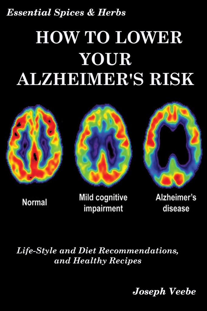 How to Lower Your Alzheimer‘s Risk: Life-Style and Diet Recommendations and Healthy Recipes (Essential Spices and Herbs #6)