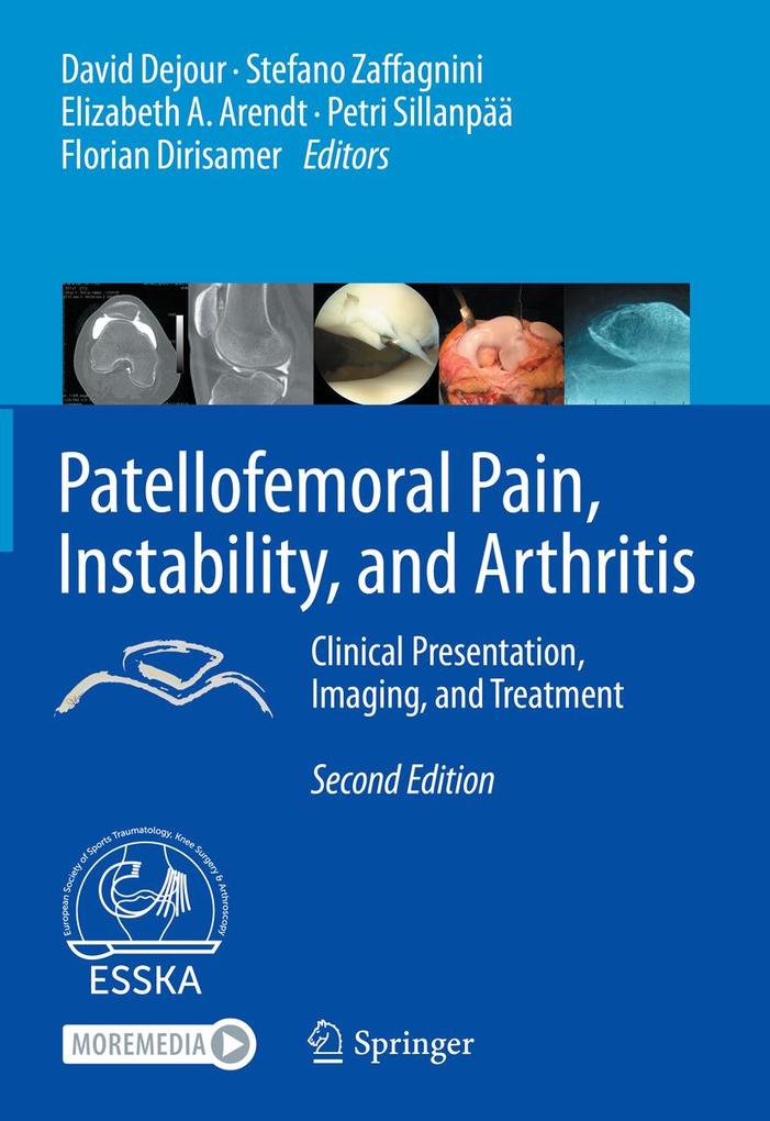 Patellofemoral Pain Instability and Arthritis