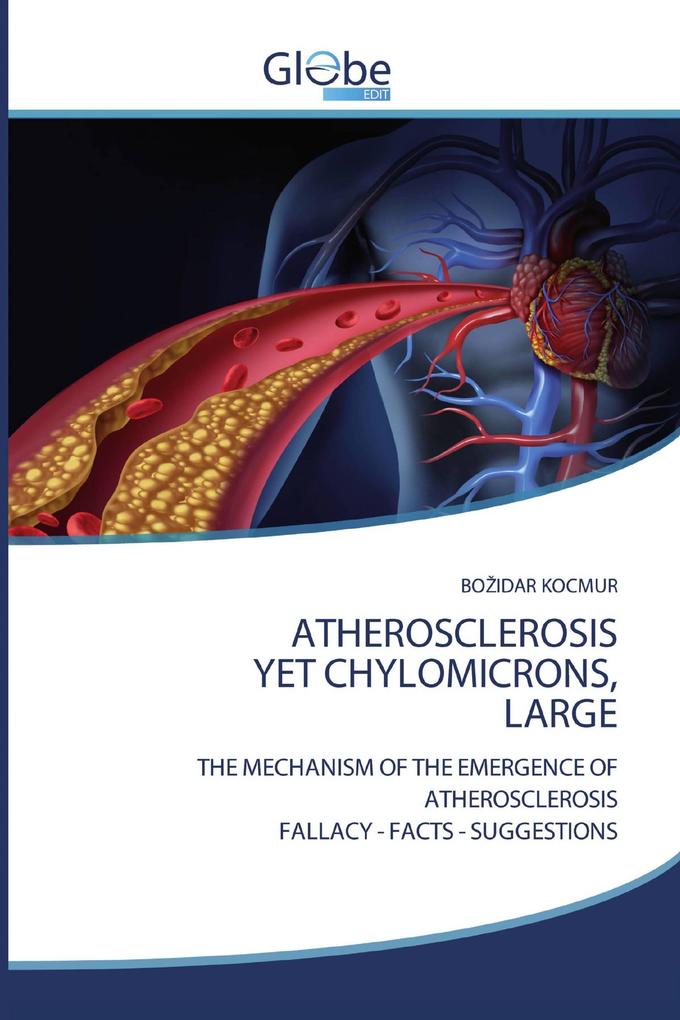 ATHEROSCLEROSIS YET CHYLOMICRONS LARGE