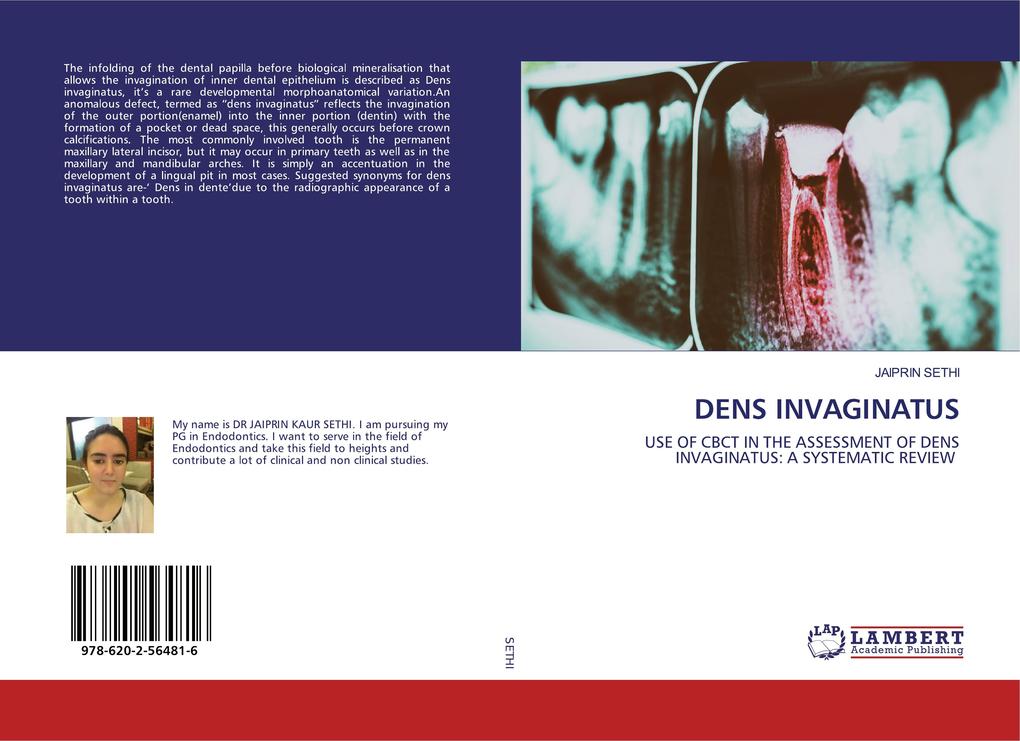 DENS INVAGINATUS