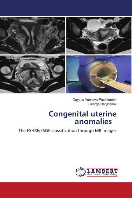 Congenital uterine anomalies