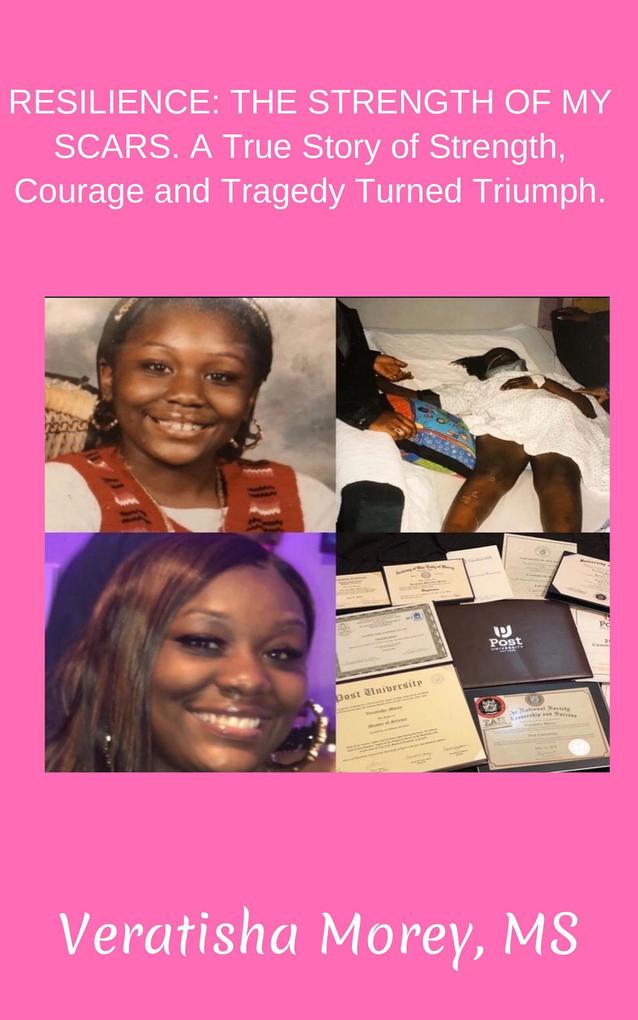 Resilience: The Strength of My Scars a True Story of Strength Courage and Tragedy Turned Triumph.