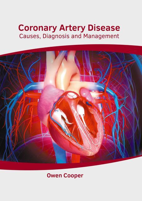 Coronary Artery Disease: Causes Diagnosis and Management