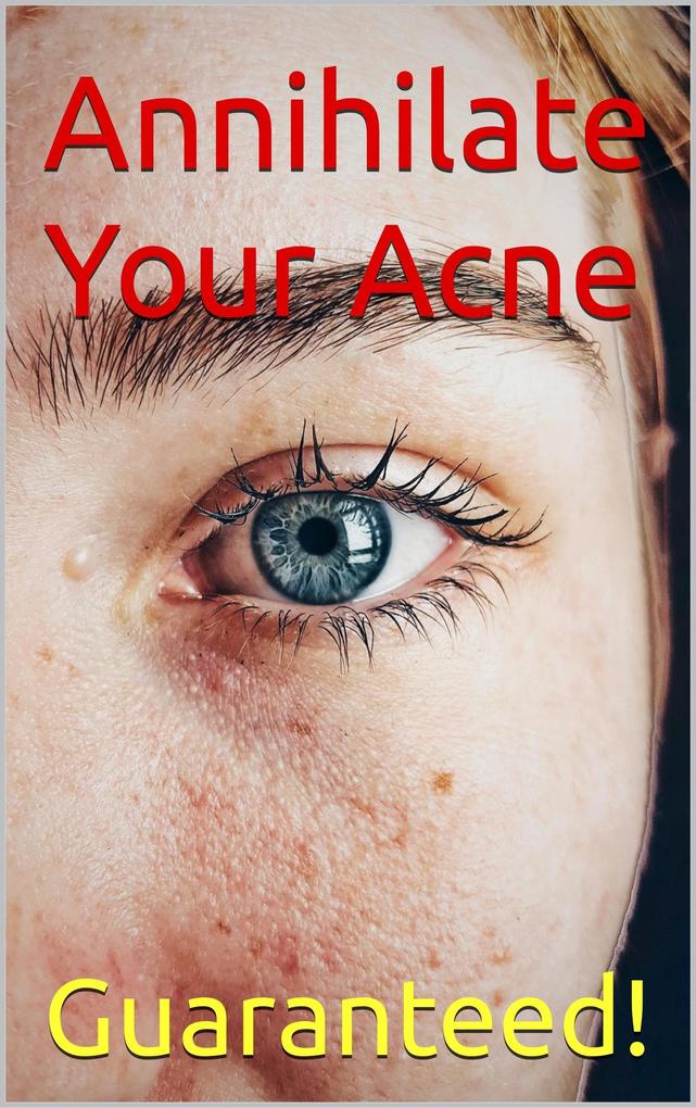 Annihilate Your Acne: How to Get Rid of Acne and Create Beautiful Clear Skin; Your Easy Proven Plan to Get Rid of Acne Fast