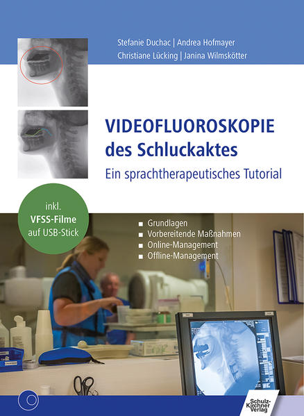 Videofluoroskopie des Schluckaktes m. Stick
