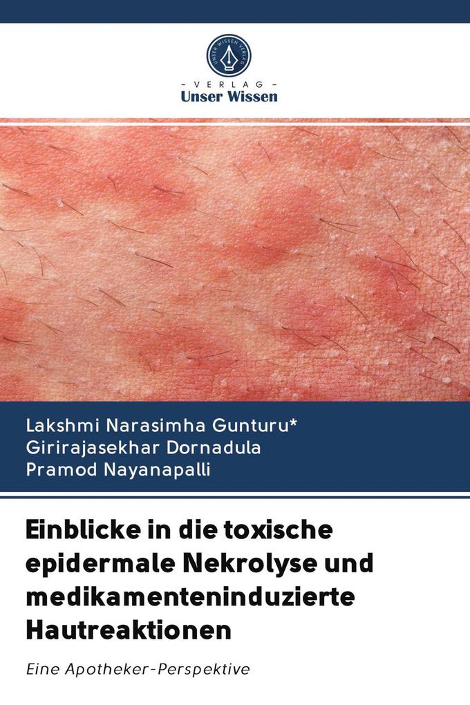 Einblicke in die toxische epidermale Nekrolyse und medikamenteninduzierte Hautreaktionen