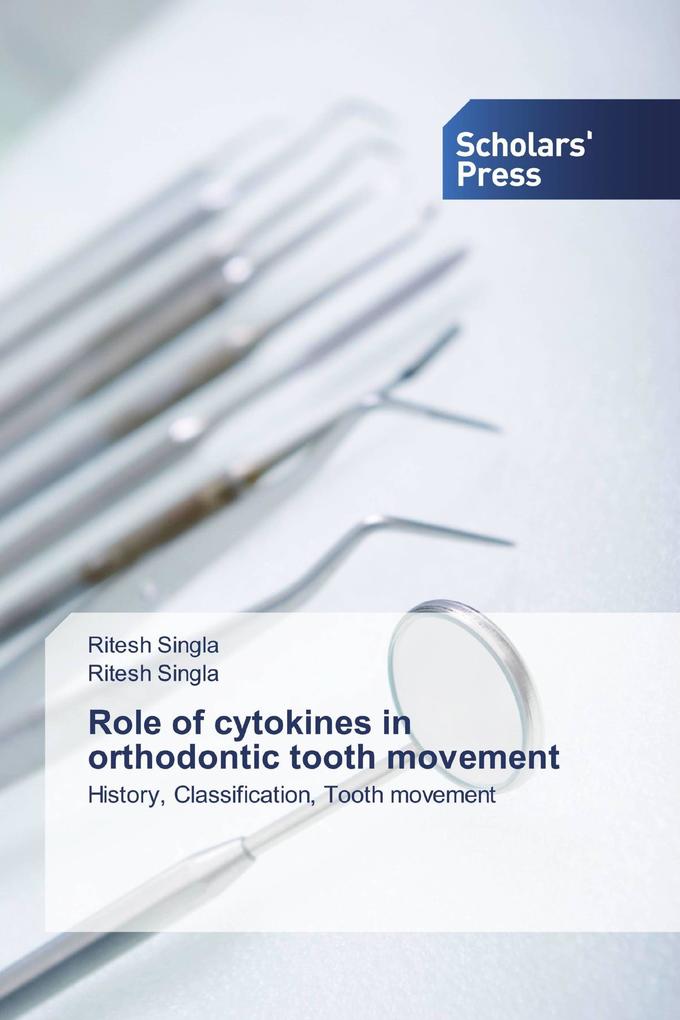 Role of cytokines in orthodontic tooth movement