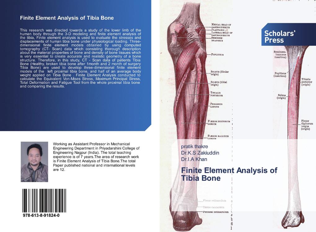 Finite Element Analysis of Tibia Bone