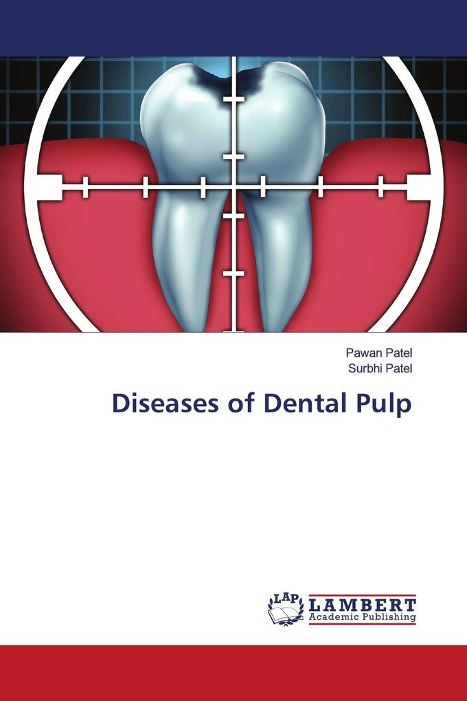 Diseases of Dental Pulp