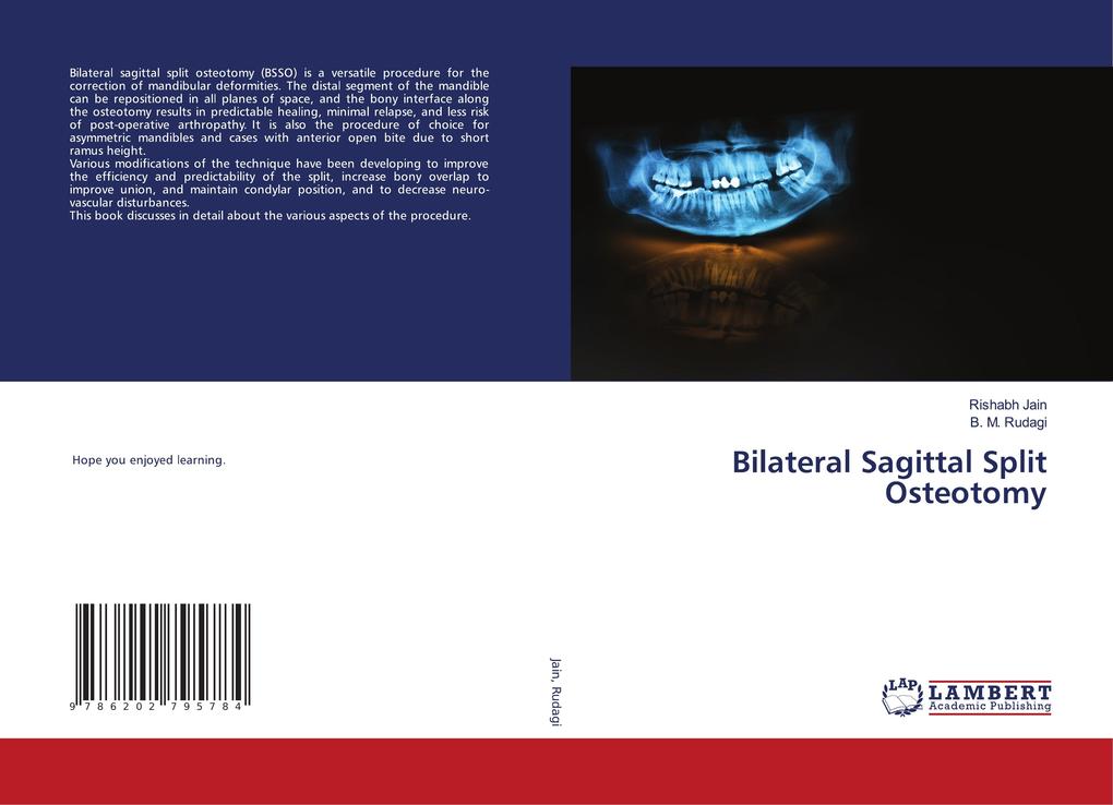 Bilateral Sagittal Split Osteotomy