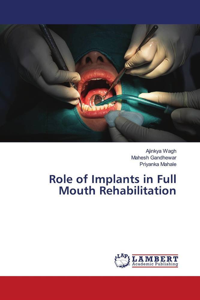 Role of Implants in Full Mouth Rehabilitation