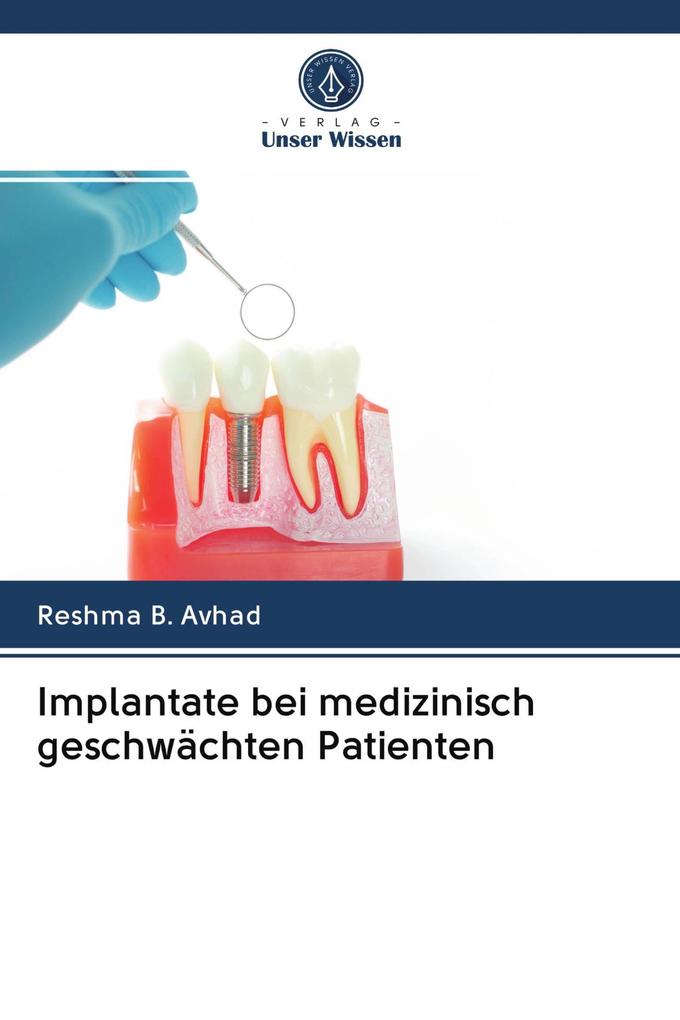 Implantate bei medizinisch geschwächten Patienten