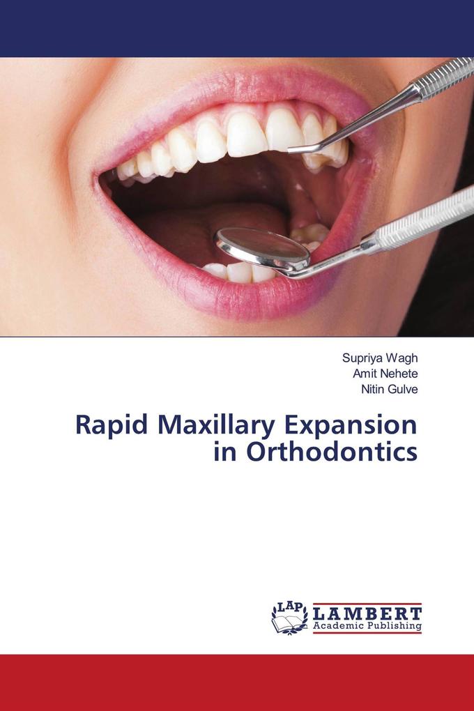 Rapid Maxillary Expansion in Orthodontics