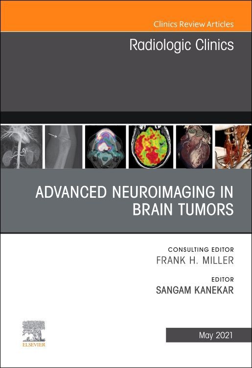 Advanced Neuroimaging in Brain Tumors An Issue of Radiologic Clinics of North America