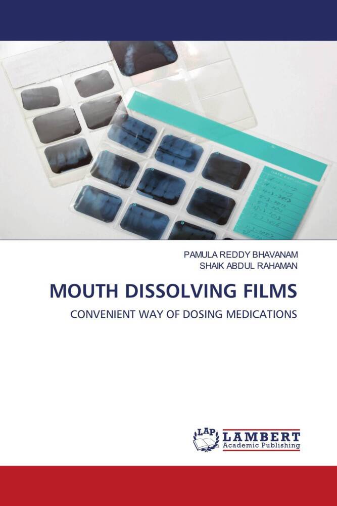 MOUTH DISSOLVING FILMS