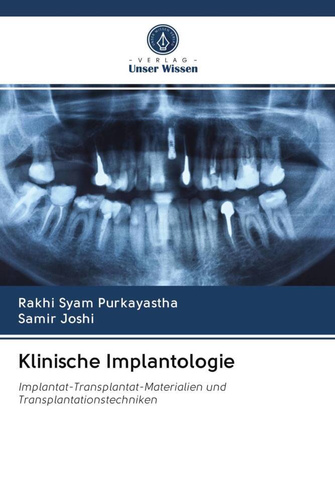 Klinische Implantologie