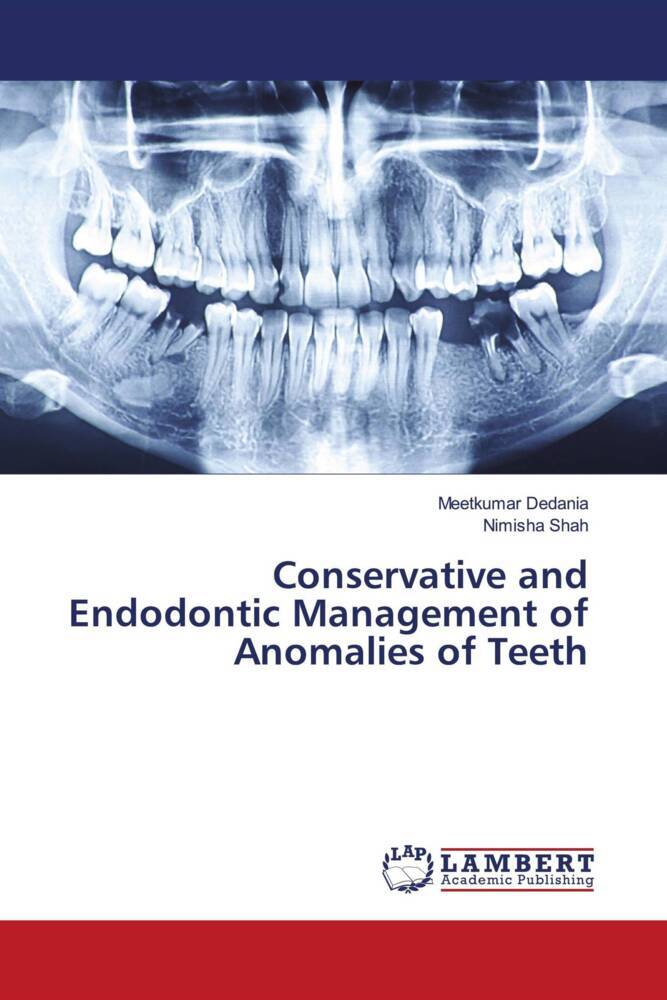 Conservative and Endodontic Management of Anomalies of Teeth