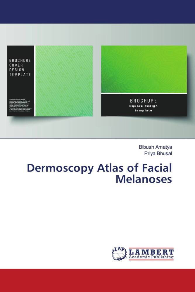 Dermoscopy Atlas of Facial Melanoses