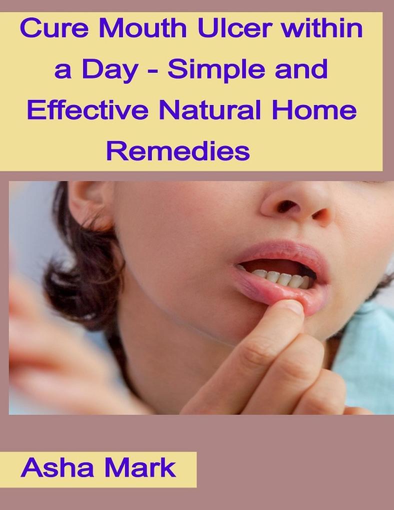 Cure Mouth Ulcer within a Day - Simple and Effective Natural Home Remedies